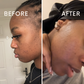 Turmeric Face mask